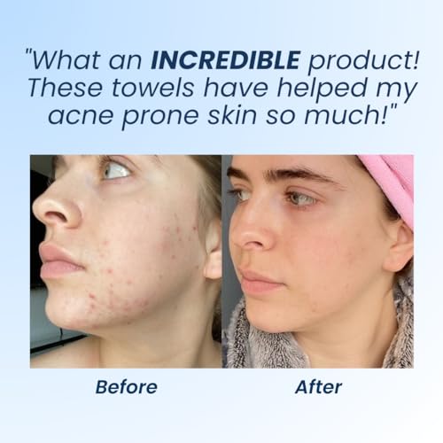Clean Skin Club Clean Towels XL, Dermatologist Approved, 100% USDA CLEAN SKIN CLUB Au supplements