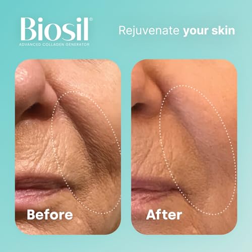 Biosil Collagen Generator - 120 Capsules - with Patented ch-OSA Complex - Generates & Protects Your Own Collagen BioSil Au supplements