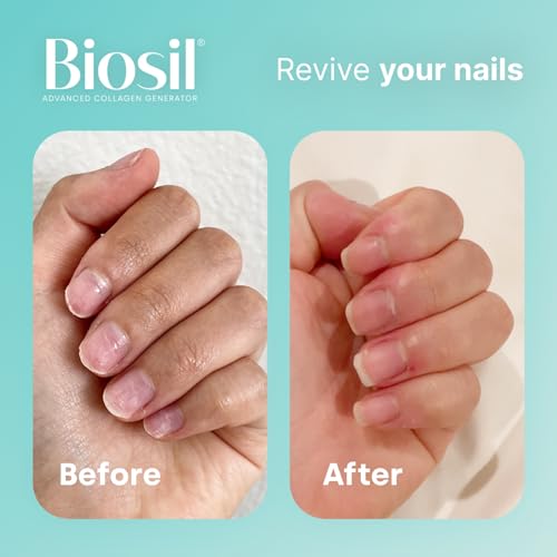 Biosil Collagen Generator - 60 Capsules - with Patented ch-OSA Complex - Generates & Protects BioSil Au supplements