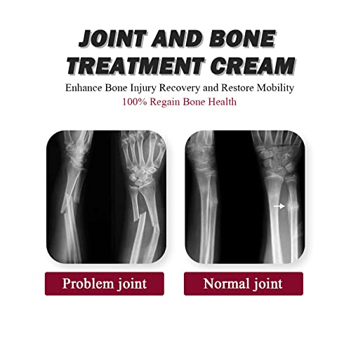 Joint Collagen Relieves Joint Soreness And Body Joint Care Collagen Get Thick Products Generic Au supplements
