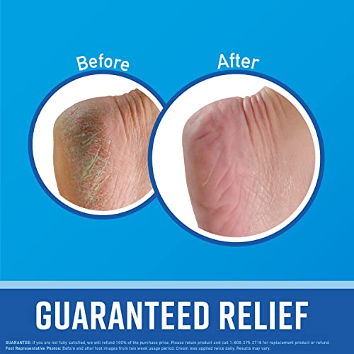 O'Keeffe's for Healthy Feet Foot Cream, Guaranteed Relief for Extremely Dry, Cracked Feet O'Keeffe's Au supplements