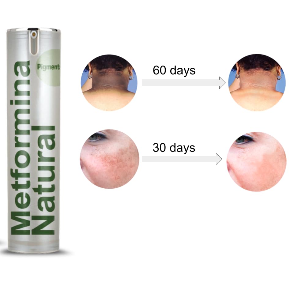 Ni una dieta más METFORMINA NATURAL - Cream for Dark Spots on Face and Body Ni una dieta más Au supplements