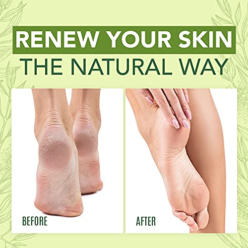 Tea Tree Oil Foot Cream For Dry Cracked Heels Repair - Natural Foot Cream For Dry Cracke USA Naturals Au supplements