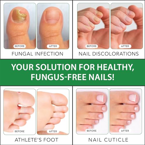Viking Revolution Toenail Fungus Treatment Extra Strength with 1% Tolnaftate OTC Viking Revolution Au supplements