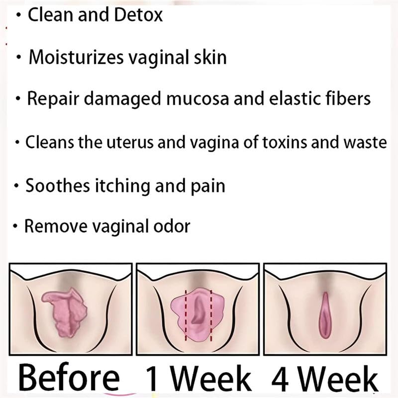 tsoneoo Dexcara Detox Repair - Natural Repair Vagianal Capsules, Natural Repair Vajinal Capsules tsoneoo Au supplements