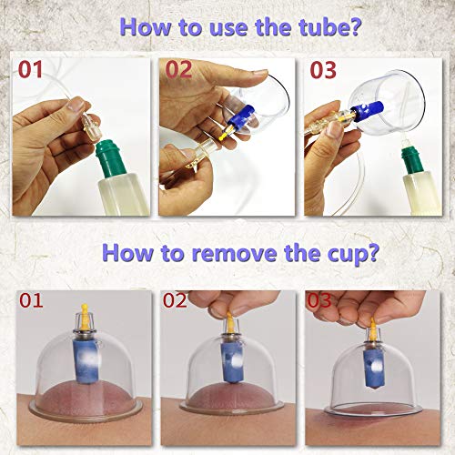 MYMM 12 Cupping Cups Sets Biomagnetic Traditional Professional Chinese Therapy Massage MYMM Au supplements