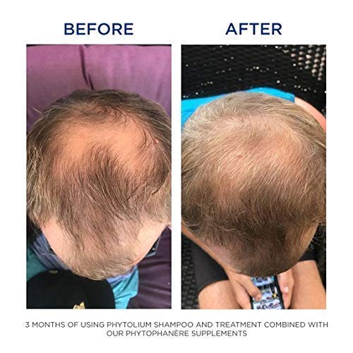 PHYTO Phytophanère 100% Natural Hair Loss Thinning Dietary Supplement PHYTO Au supplements