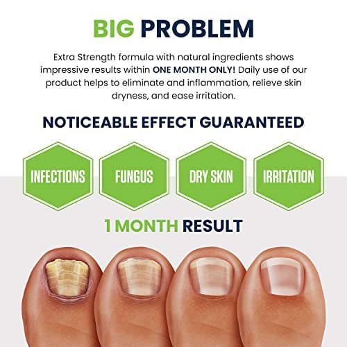 Toenail Fungus Treatment Extra Strength - Advance nail fungus treatment for fingernails FOOT CURE Au supplements