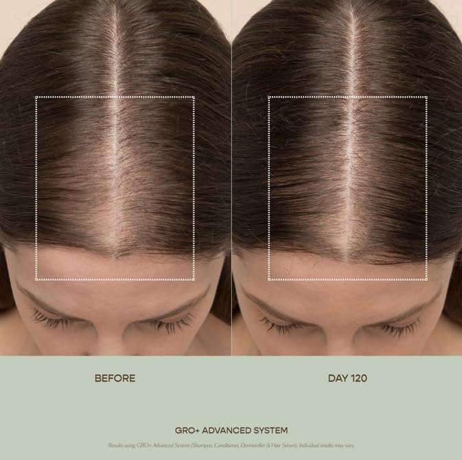 VEGAMOUR GRO+ Advanced Hair Serum for Improving Hair Density, Tonic Reduces Shedding and Promotes a Healthy Scalp, 3 pack VEGAMOUR Au supplements