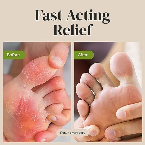 Puriya Tea Tree Oil Antifungal Cream, Plant-Powered Athletes Foot Cream Treatment Puriya Au supplements