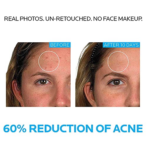 La Roche-Posay Effaclar Dermatological 3 Step Acne Treatment System La Roche-Posay Au supplements