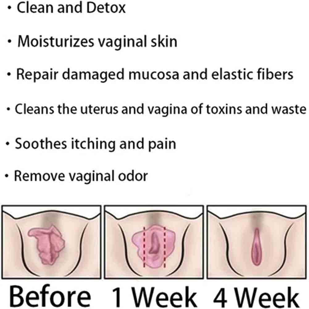 AnnieCare Instant Anti-Itch Detox Products, Annie Care Capsulas, Firming Repair & Pink Weabet Au supplements