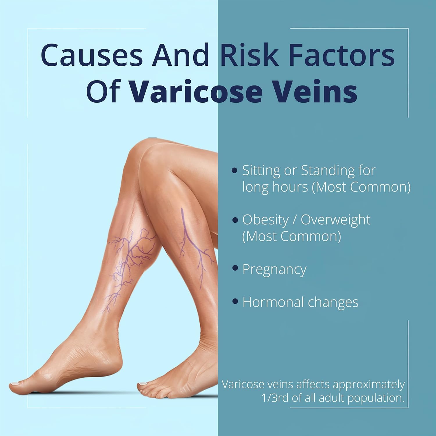 Cream Ayurvedic Solution for Management of Varicose Veins, Spider Veins, Varicocele Helps Reach The Root Cause of varicose Veins Reduces Cramps, Itching & Swelling. Single Tube (25 GMS). Generic Au supplements