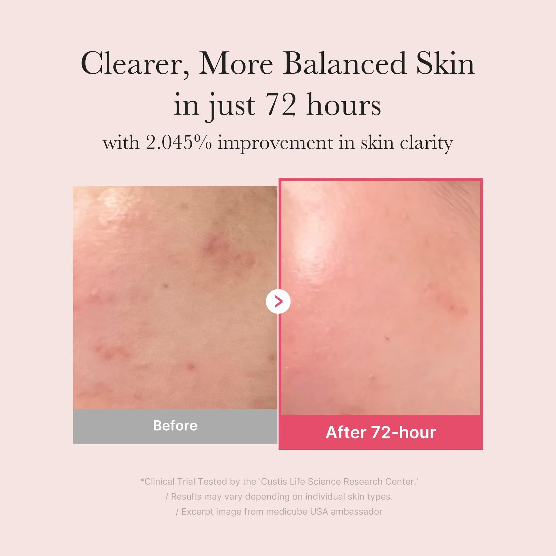 medicube TXA+Niacinamide 15% Glow Facial Serum for After Spot Care | All-in-One Daily Korean Skincare | Uneven Skin Tone, Texture, and Hydration Care | High-Potency Tranexamic Acid 5% | 1.01 fl.oz medicube Au supplements