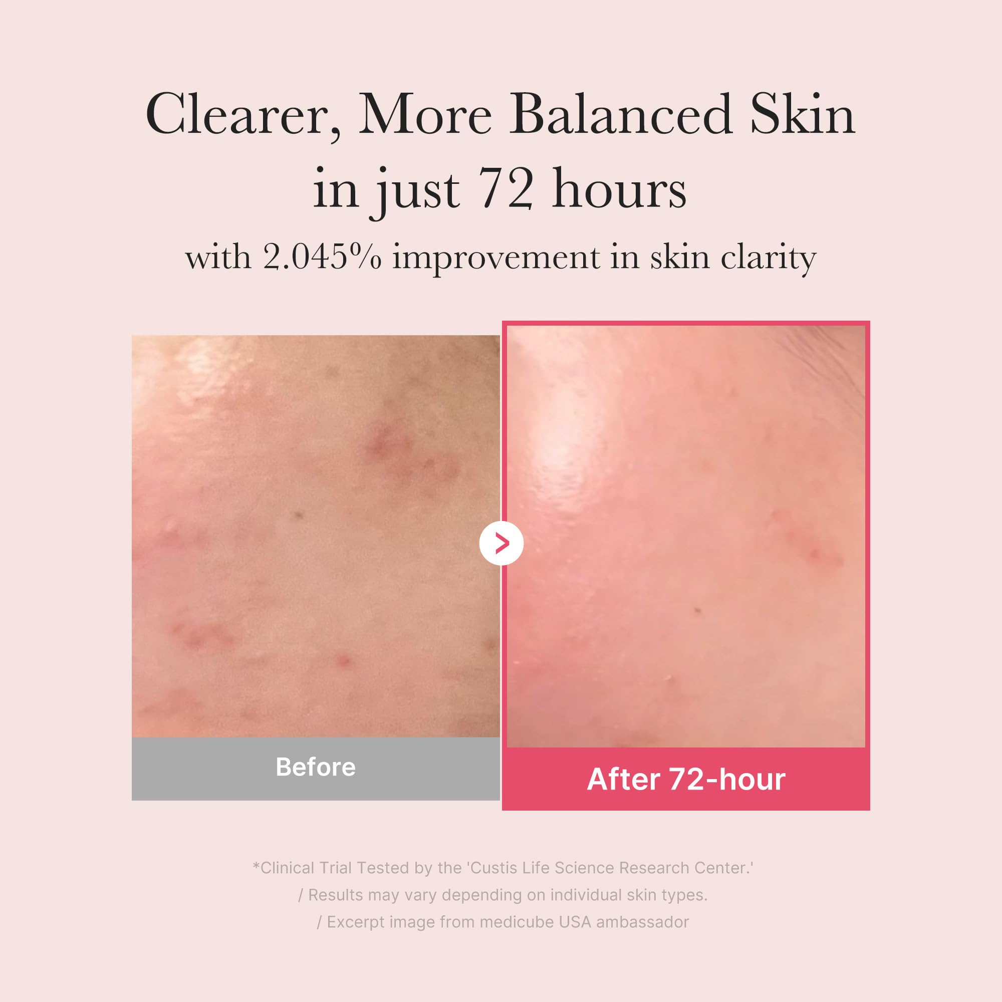 medicube TXA+Niacinamide 15% Glow Facial Serum for After Spot Care | All-in-One Daily Korean Skincare | Uneven Skin Tone, Texture, and Hydration Care | High-Potency Tranexamic Acid 5% | 1.01 fl.oz medicube Au supplements