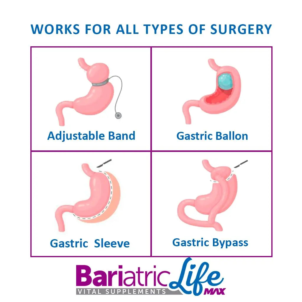 Bariatric Multivitamin Design for Post Bariatric Surgery Mens Patients, Sugar Free, 100+ Vitamins, Minerals & Amino Acids, Supports Muscle, Heart Bariatric Life Max Au supplements