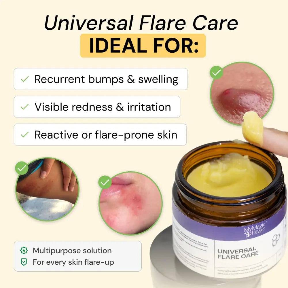MyMagicHealer Universal Flare Care – Multi-Purpose Solution | Skin Flare-Ups - Hidradenitis Suppurativa, Folliculitis, Boils, Cysts | Anti-Chafing | Irritated Skin Relief w/Propolis & Egg Yolk 1 oz MyMagicHealer Au supplements