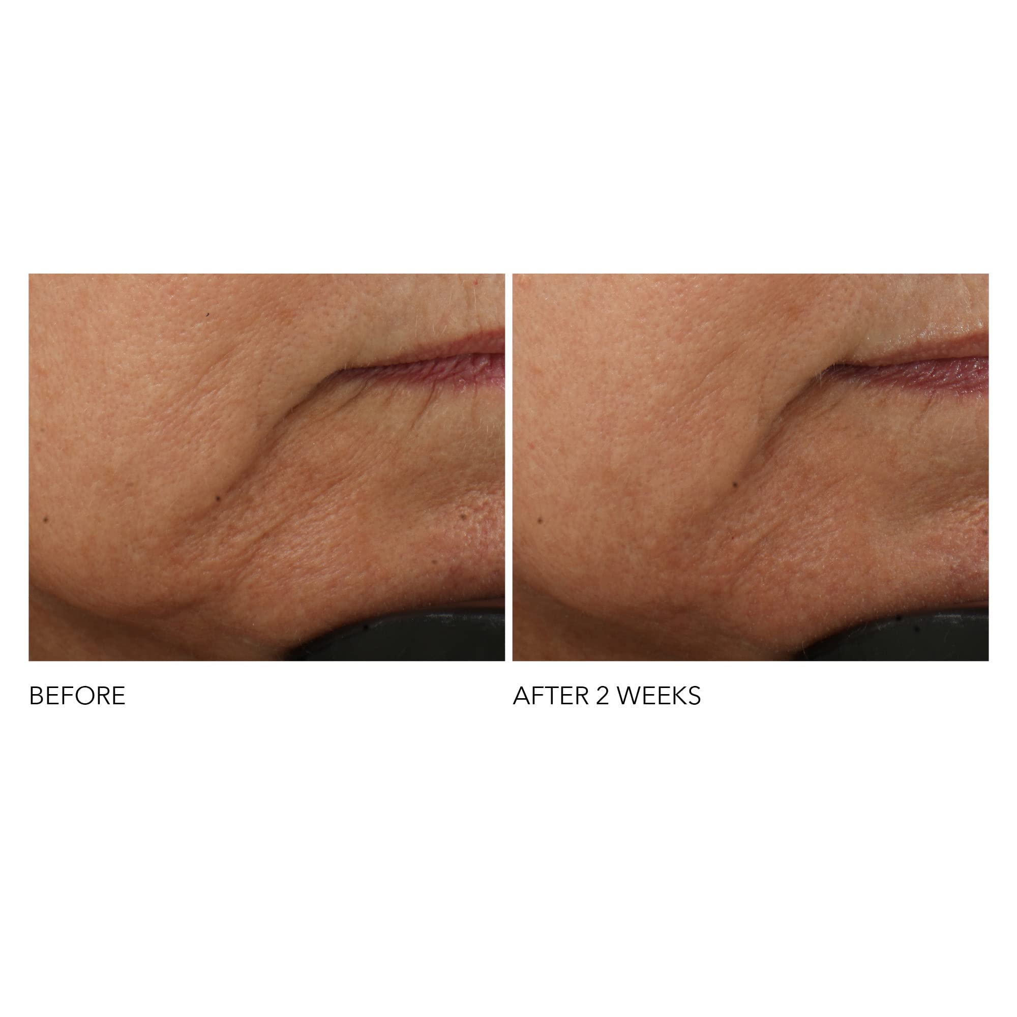 Dr Dennis Gross Advanced Retinol + Ferulic Intense Wrinkle Cream | Intensely Hydrating to Visibly Transform Skin and Repair the Moisture Barrier | 2 oz Dr Dennis Gross Au supplements