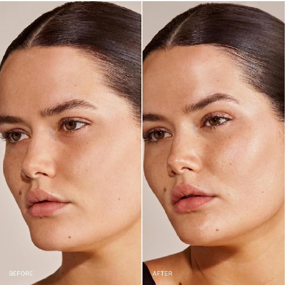 M Great Skin Instant Glow Serum with Niacinamide and Hyaluronic Acid (1.69 oz / 50 ml) + Bonus Acne Patch (36 Pieces) Tea Tree Oil Facial Water Gel NAPH Au supplements