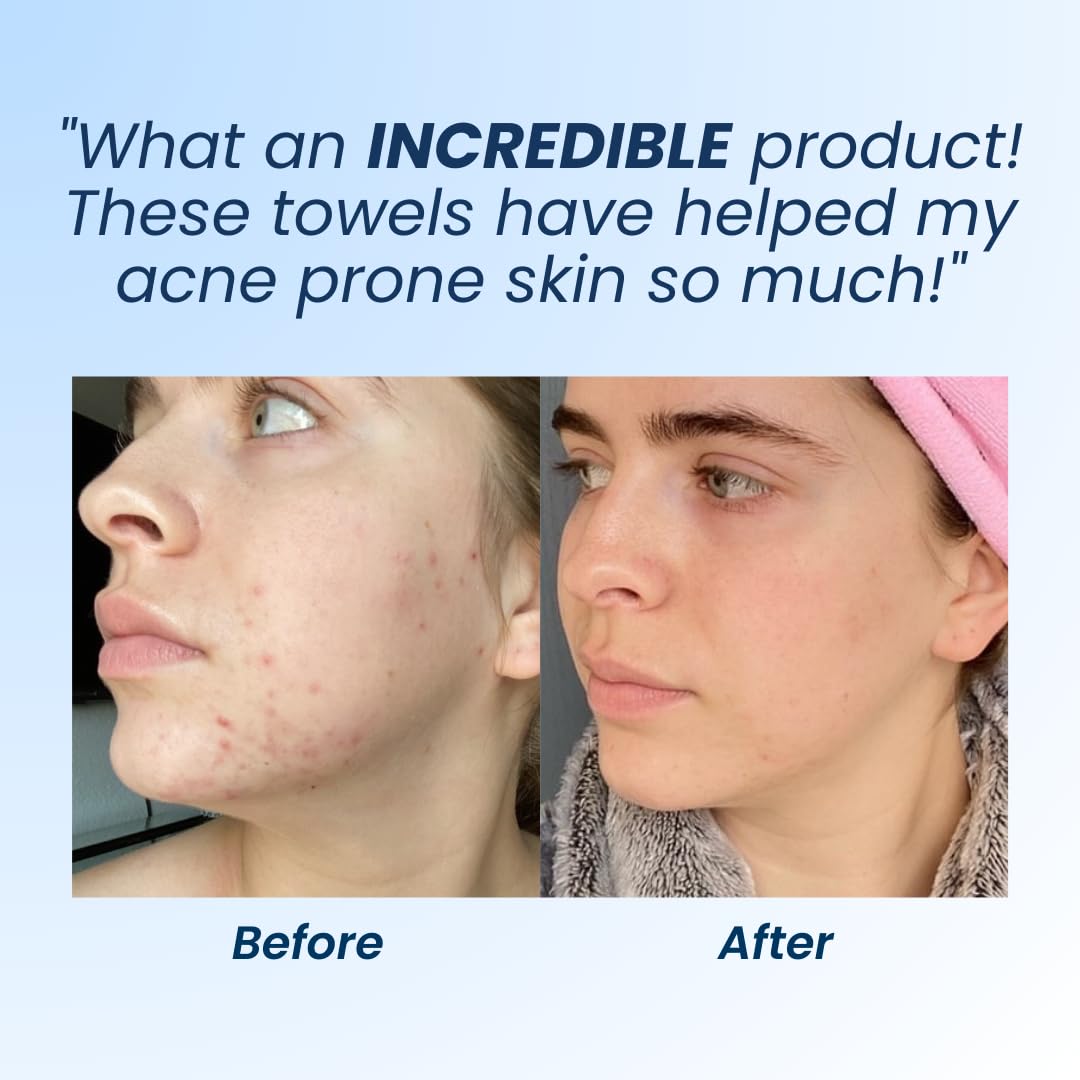 Clean Skin Club Clean Towels XL, 100% USDA Biobased Dermatologist Appr CLEAN SKIN CLUB Au supplements