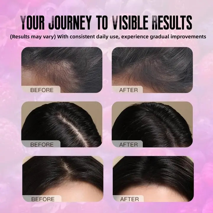 BDQBDQ Lumin Hair Growth Gummies, Infused with Biotin, Vitamins, and Botanical Extracts to Support Healthy Hair Growth and Strength BDQBDQ Au supplements