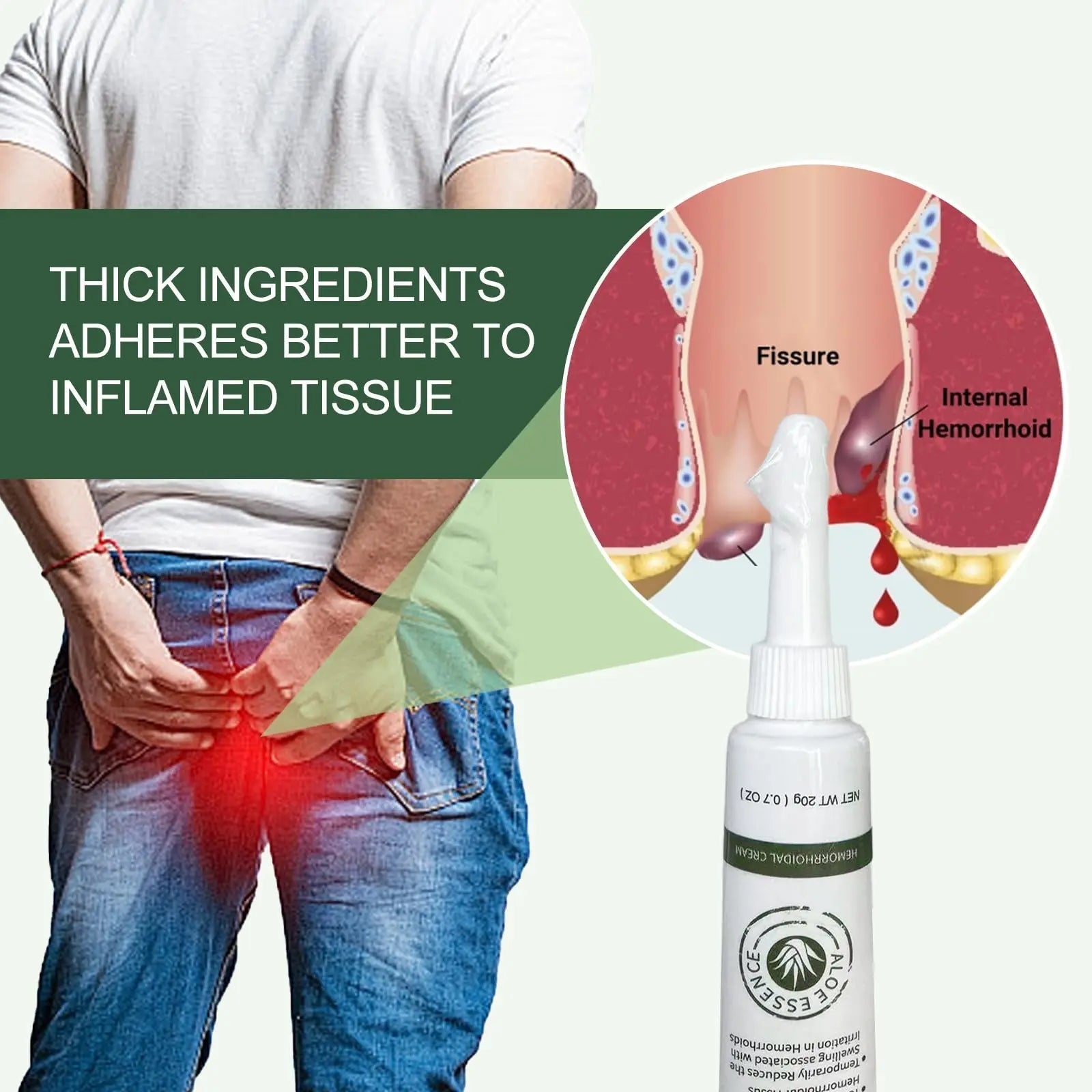 Hemorrhoid & Fissure Ointment, Hemorrhoid Treatment and Hemorrhoid Cream with Lidocaine 4% and Phenylephrine HCI for Fast Relief of Pain, Swelling, Itching, Burning, Hemorrhoidal treatment, 2 Pack-J2 Emisun Au supplements