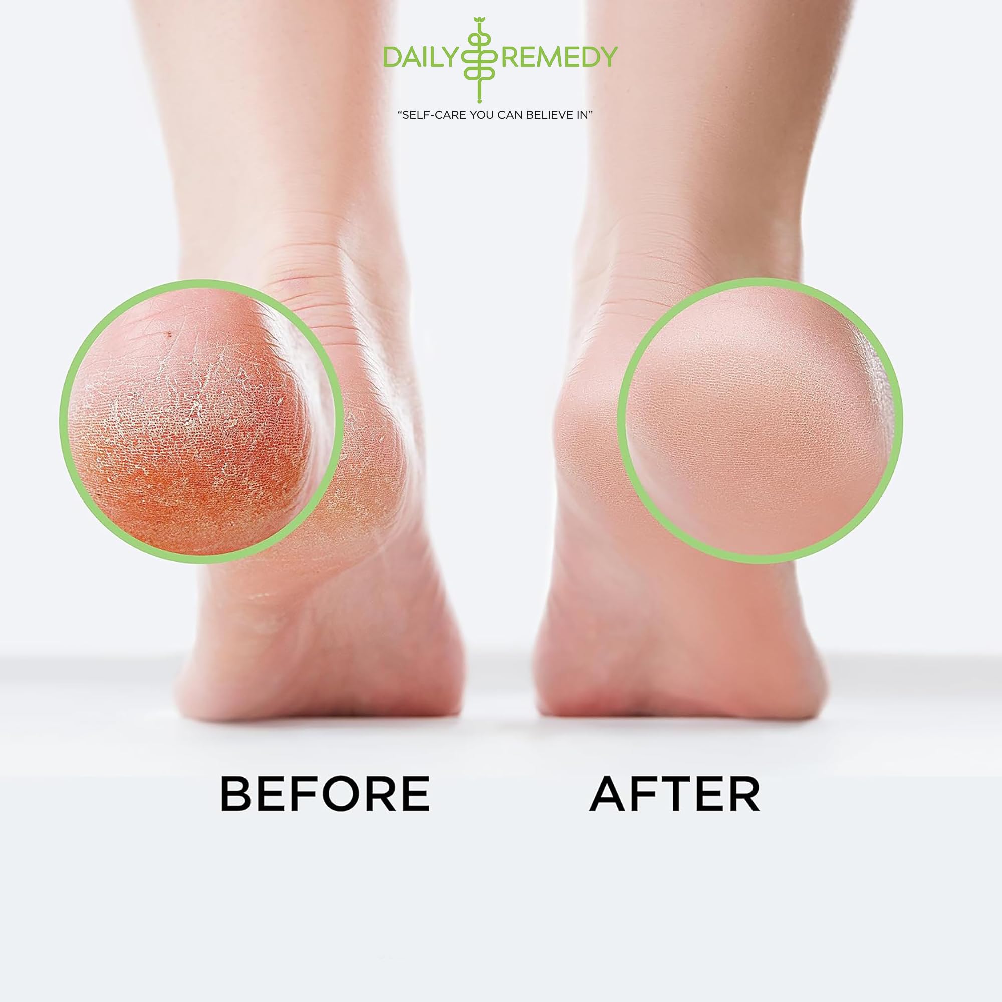 Tea Tree Oil Foot Soak with Epsom Salt - Made in USA - for Toenail Athletes Foot DAILY REMEDY Au supplements
