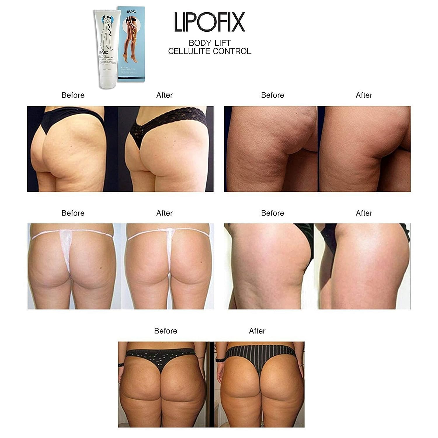 LIPOFIX Anti Cellulite Cream Luxurious Formula Body Contour Cream Effectively Tone LIPOFIX Au supplements