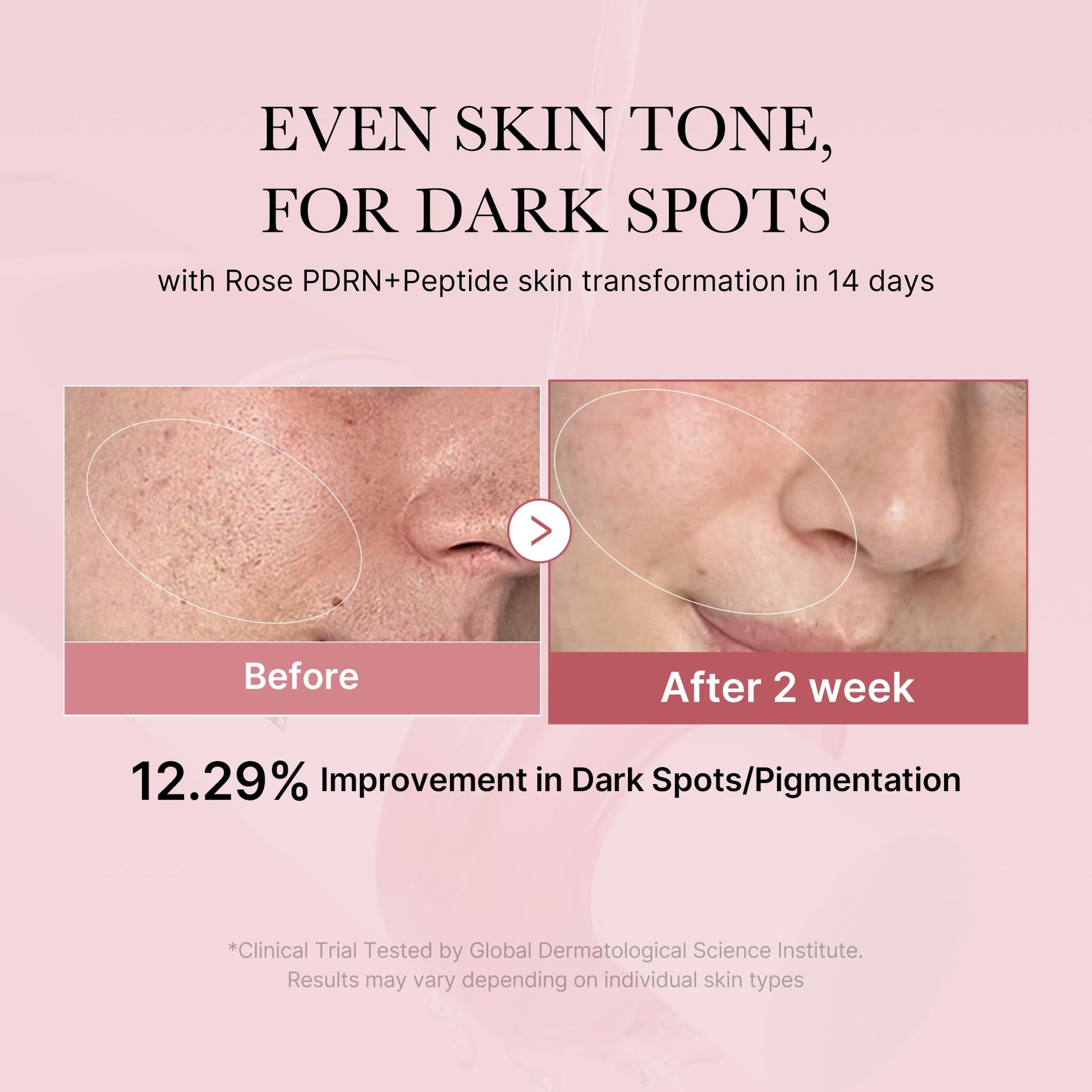 medicube PDRN Toner Rose PDRN Peptide Toner | Lightweight & Watery Type for Skin Boosting, Soothing and Calming, Uneven Skin Tone | with Rose, Peptide, Niacinamide | Korean Skincare, 8.45 fl.oz medicube Au supplements