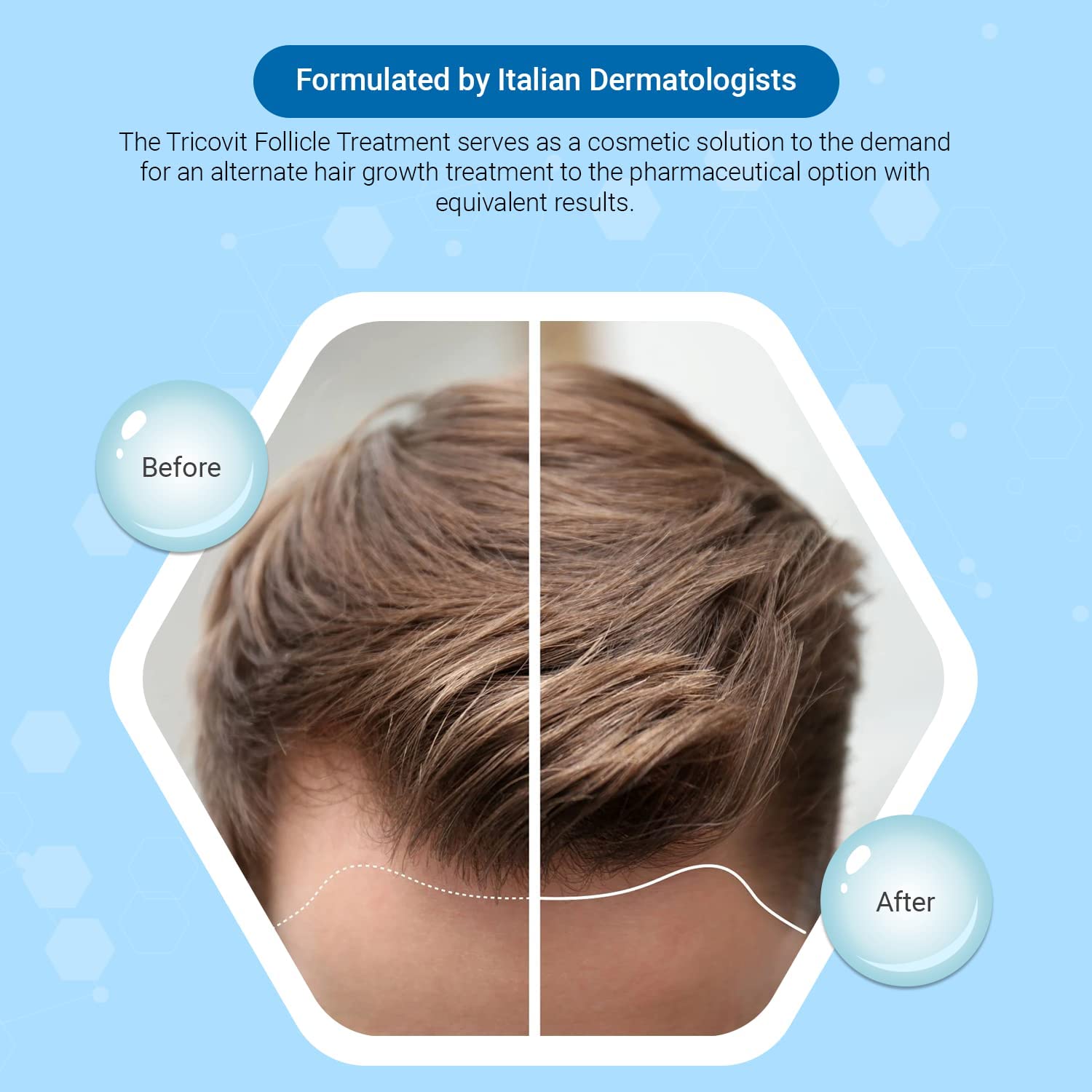 Tricovit Hair Growth Supplement - Nail & Hair Health Vitamins with Amino Acids, Minerals & Antioxidants - Dermatologist-Formulated & Gluten-Free Vitamins and Supplements for Women & Men (60 tablets) Tricovit Au supplements