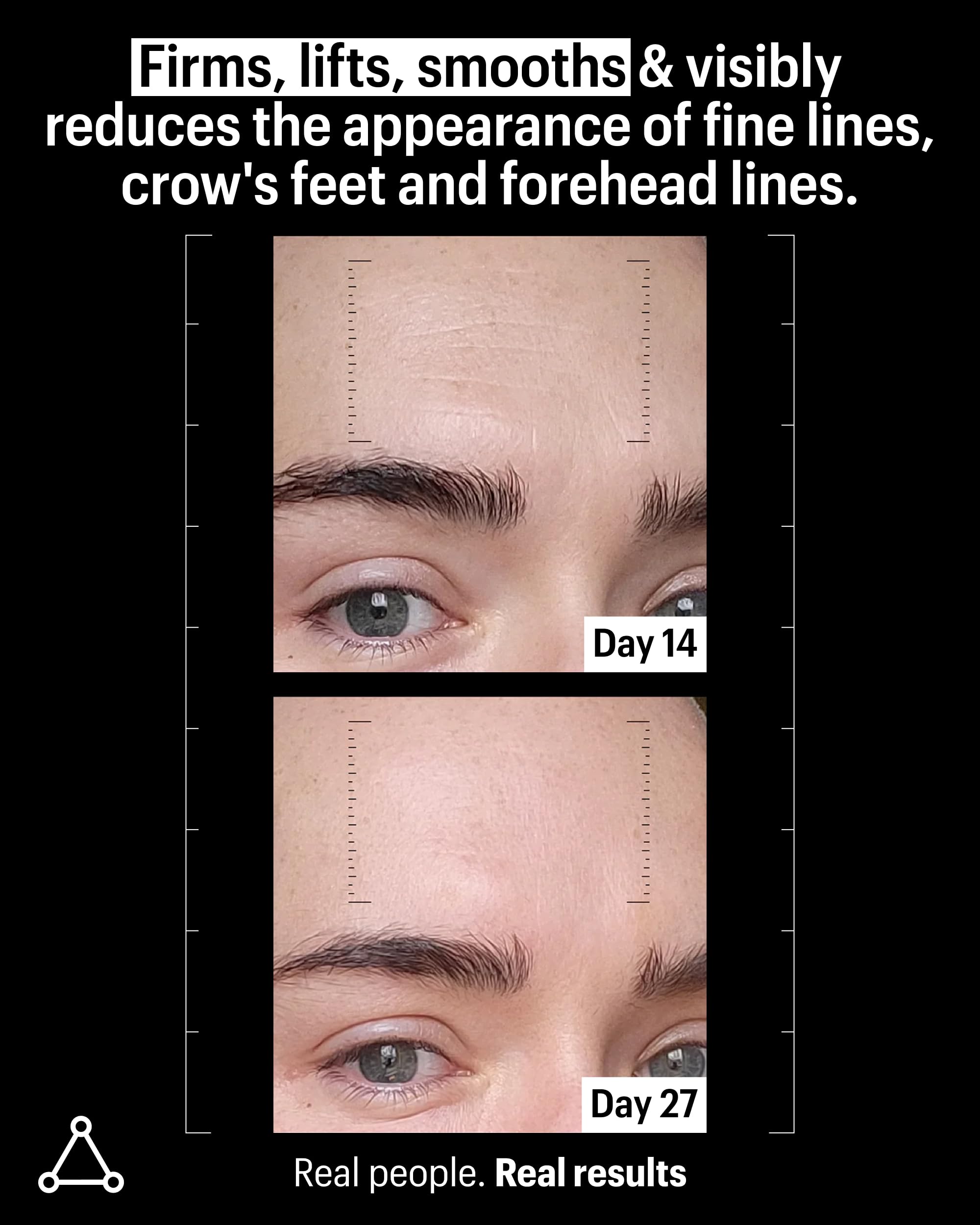 Allies of Skin Multi Peptides & Growth Factor Collagen Boosting Face Serum | Skin Tightening Anti-Aging Complex with 9% Peptides| Firms Sagging Skin & Visibly Reduces Wrinkles (1 oz) Allies of Skin Au supplements