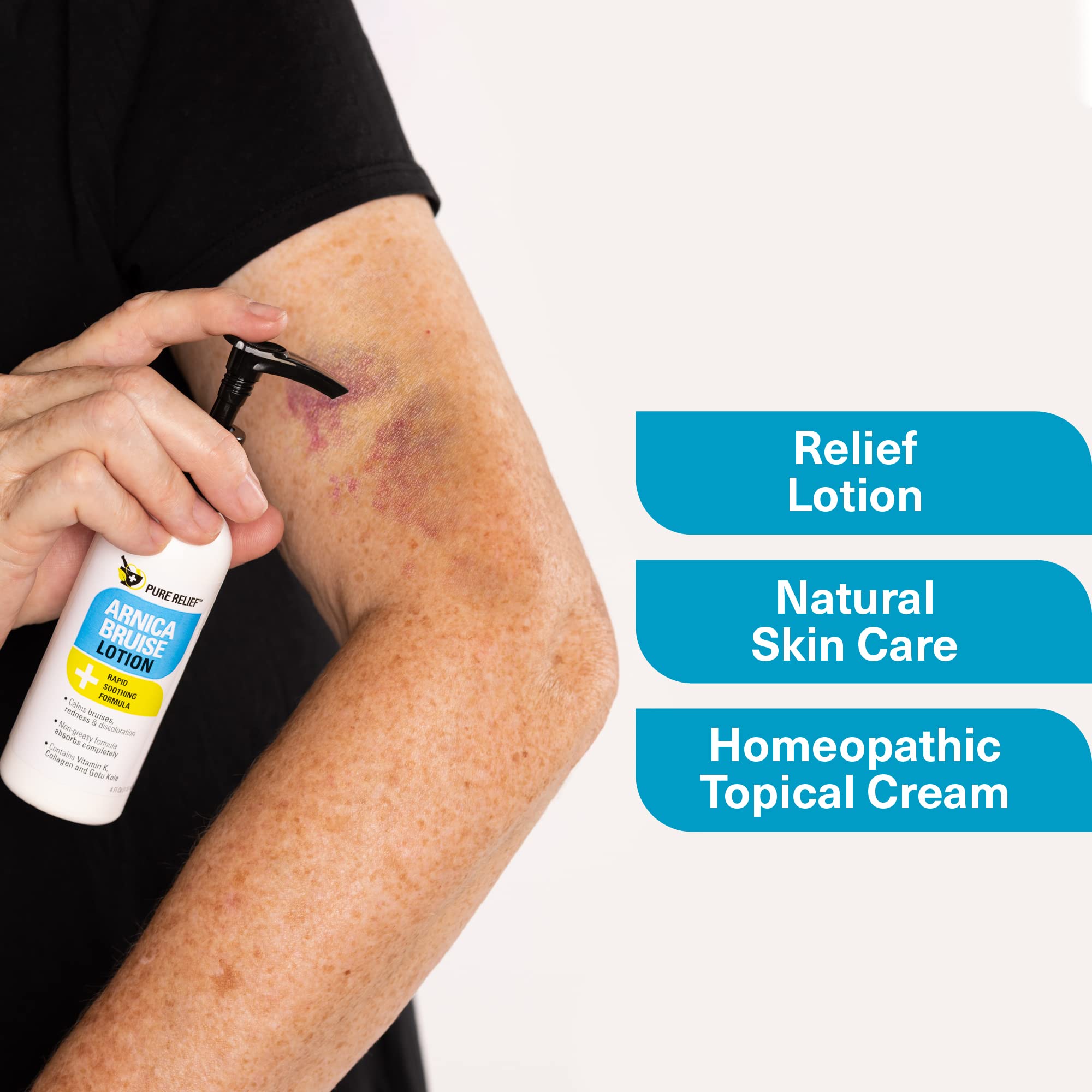 Pure Relief Arnica Bruise Relief Lotion for Bruising, Swelling, & Discoloration On Skin, Natural Skin Care Arnica Bruise Homeopathic Topical Bruise Cream W/Aloe Vera & Collagen, 4 Fl Oz (Pack of 3) Pure Relief Au supplements