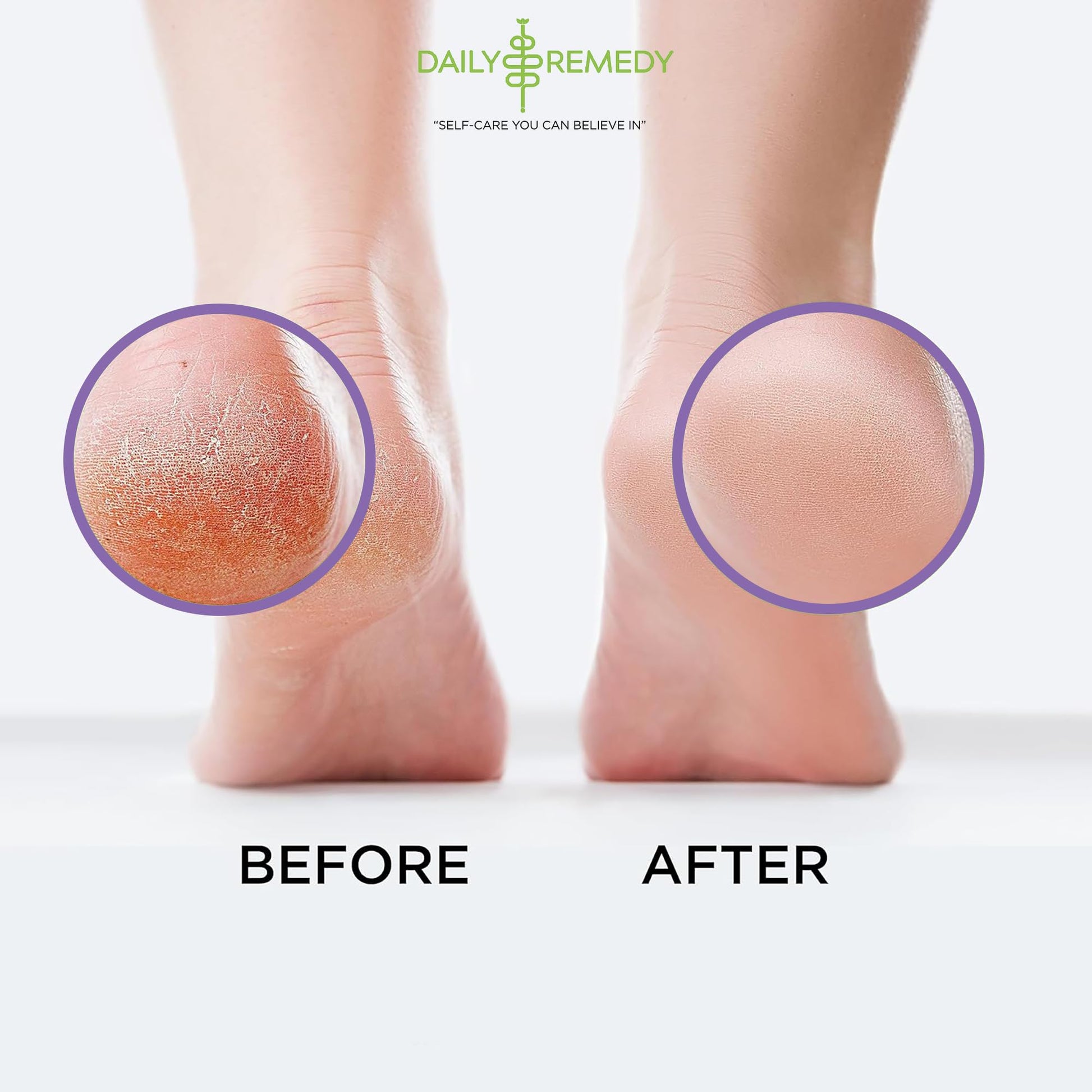 Calming Lavender Foot Soak with Epsom Salt, Made in USA, Foot Soak Soothes Sore Tired DAILY REMEDY Au supplements