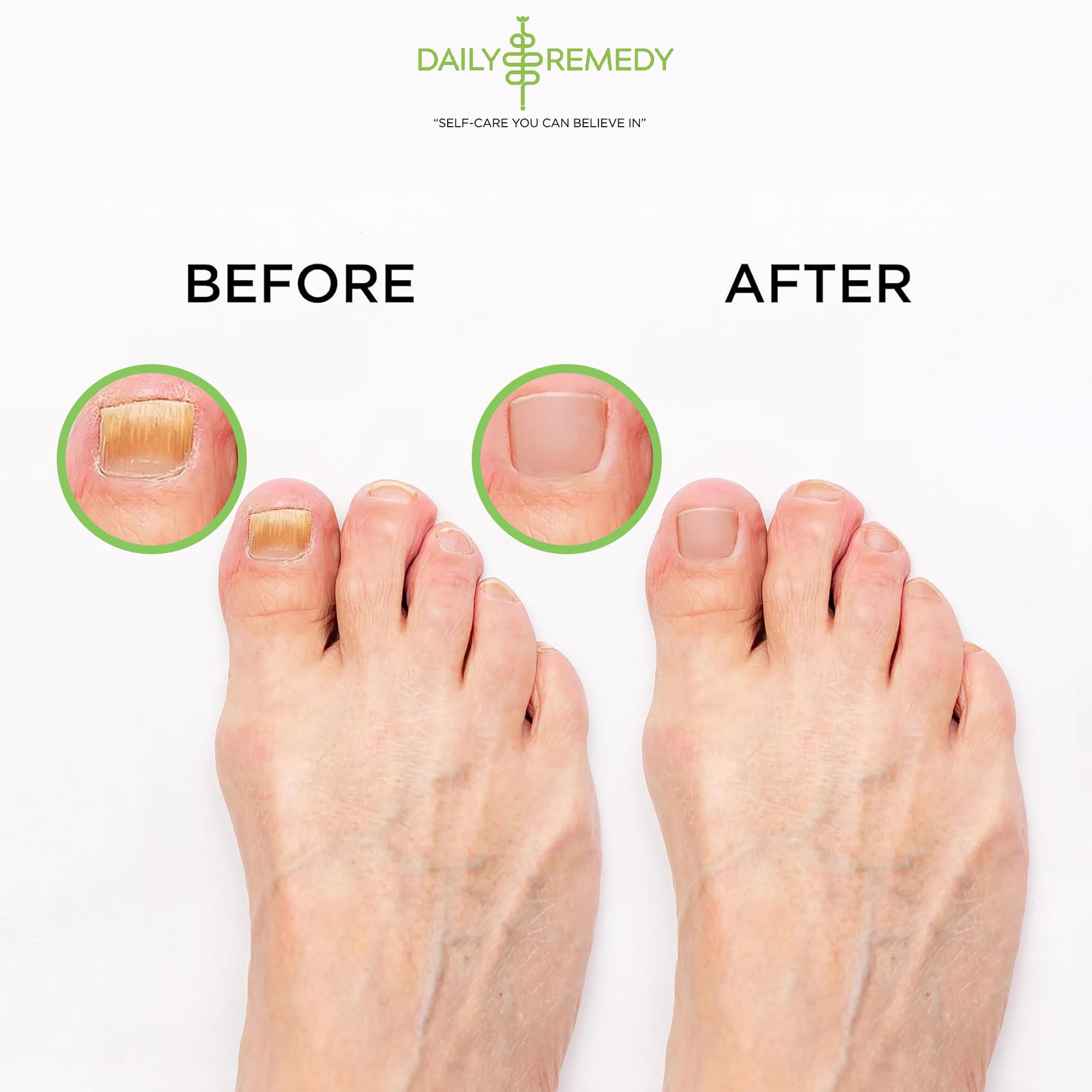 Tea Tree Oil Foot Soak with Epsom Salt - Made in USA - for Toenail Athletes Foot DAILY REMEDY Au supplements