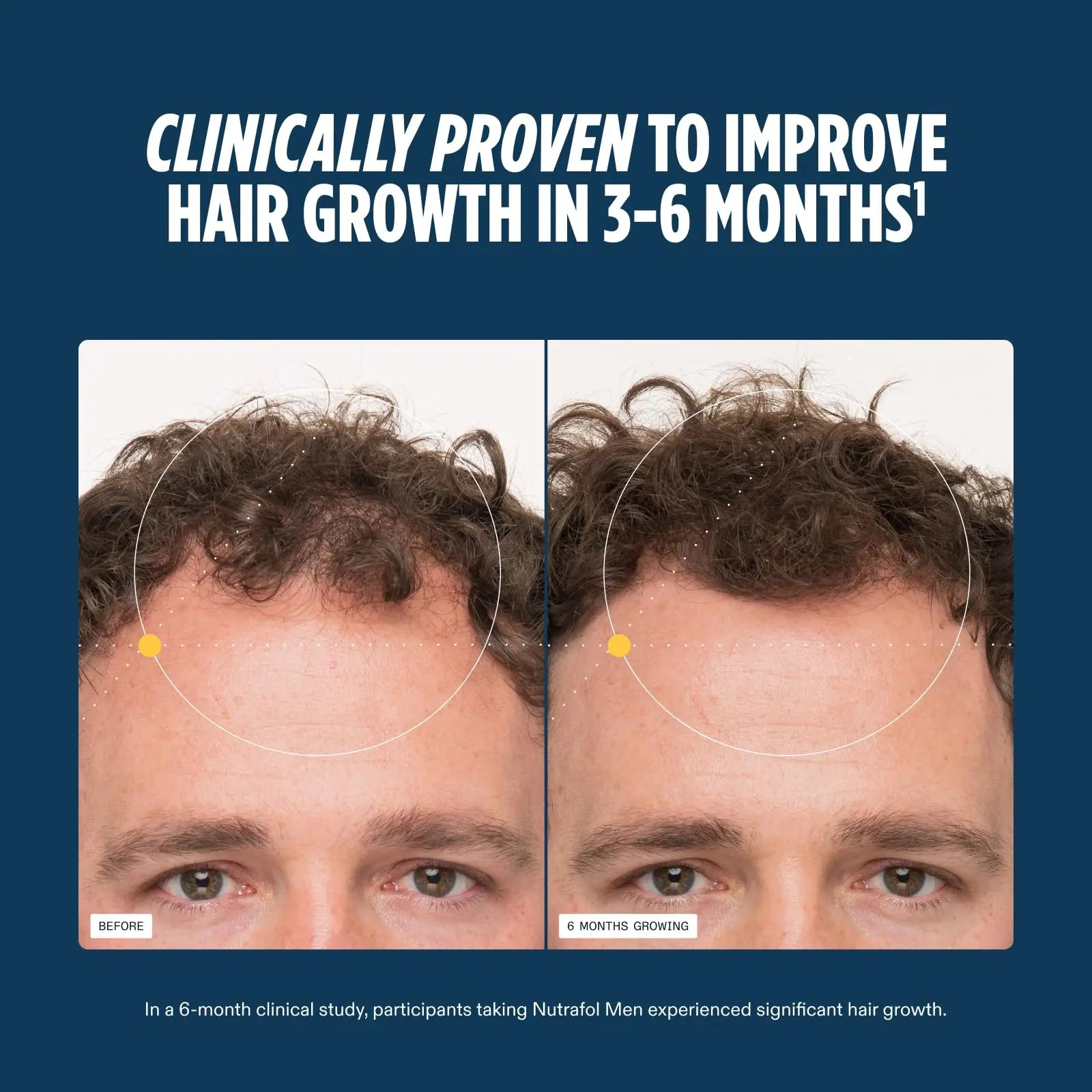 Nutrafol Men's Hair Growth Supplements, Clinically Tested for Visibly Thicker Hair and Scalp Coverage, Dermatologist Recommended - 1 Month Supply Nutrafol Au supplements