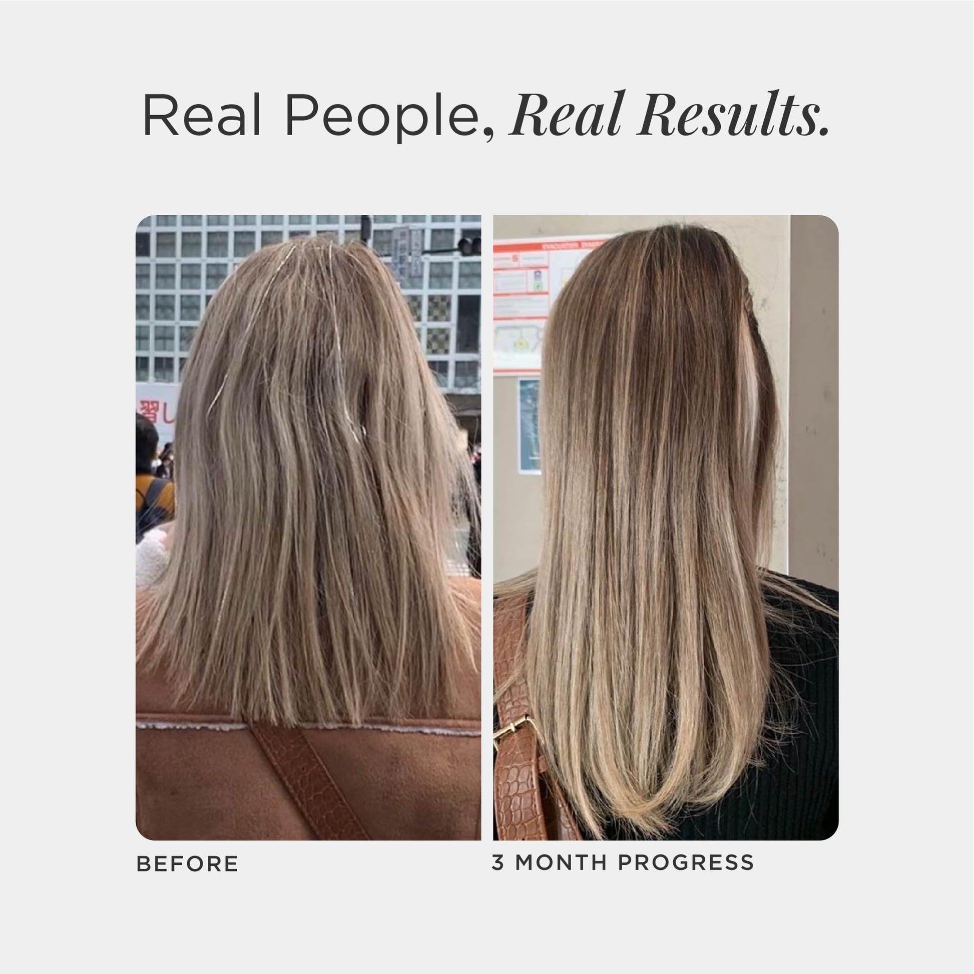 JSHealth Hair Growth Vitamins for Women. Hair + Energy with Kelp Iodine and Zinc. Supports Thickness, Strength, Energy. Nutritionist-Formulated (60 Capsules) JSHealth Au supplements