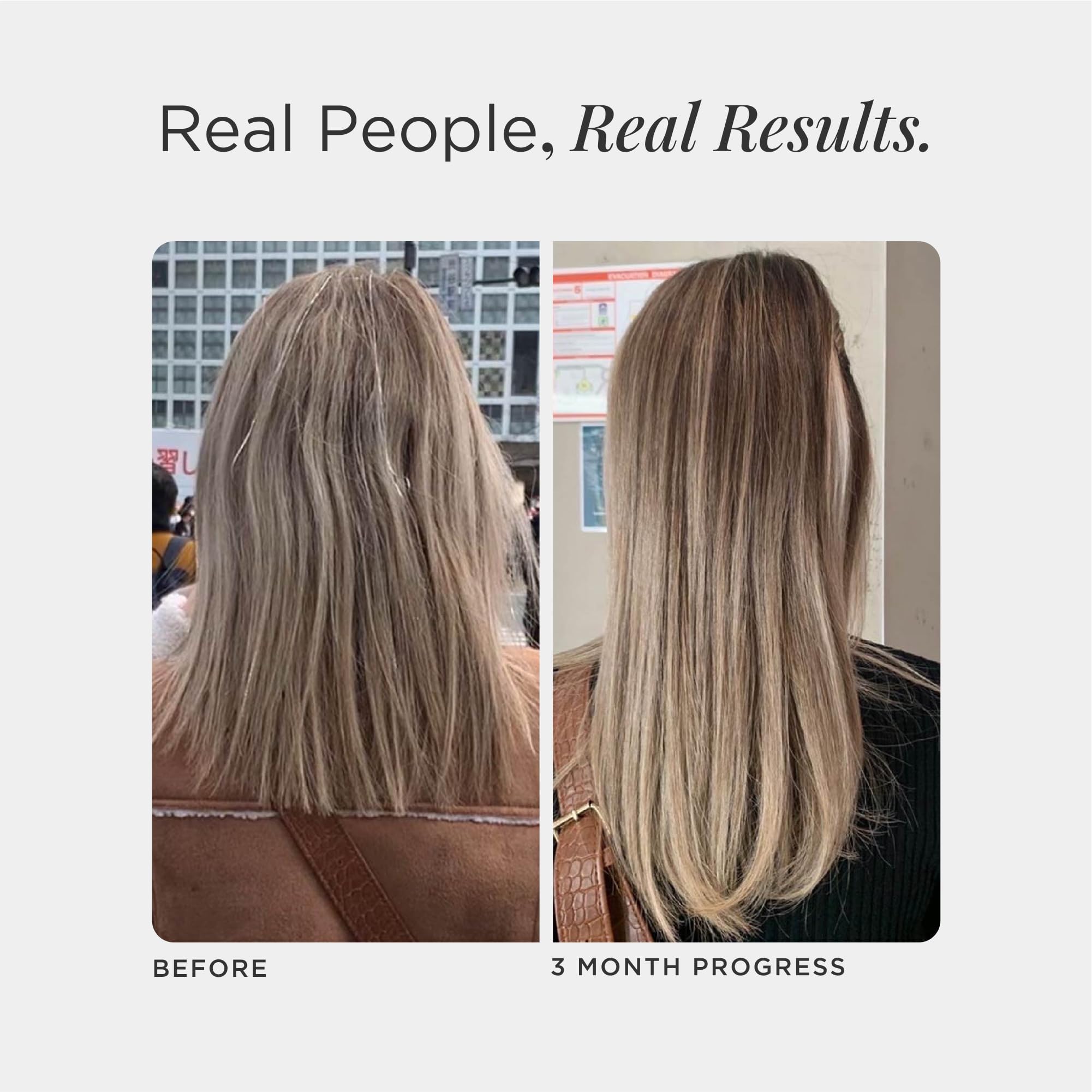 JSHealth Hair Growth Vitamins for Women. Hair + Energy with Kelp Iodine and Zinc. Supports Thickness, Strength, Energy. Nutritionist-Formulated (60 Capsules) JSHealth Au supplements