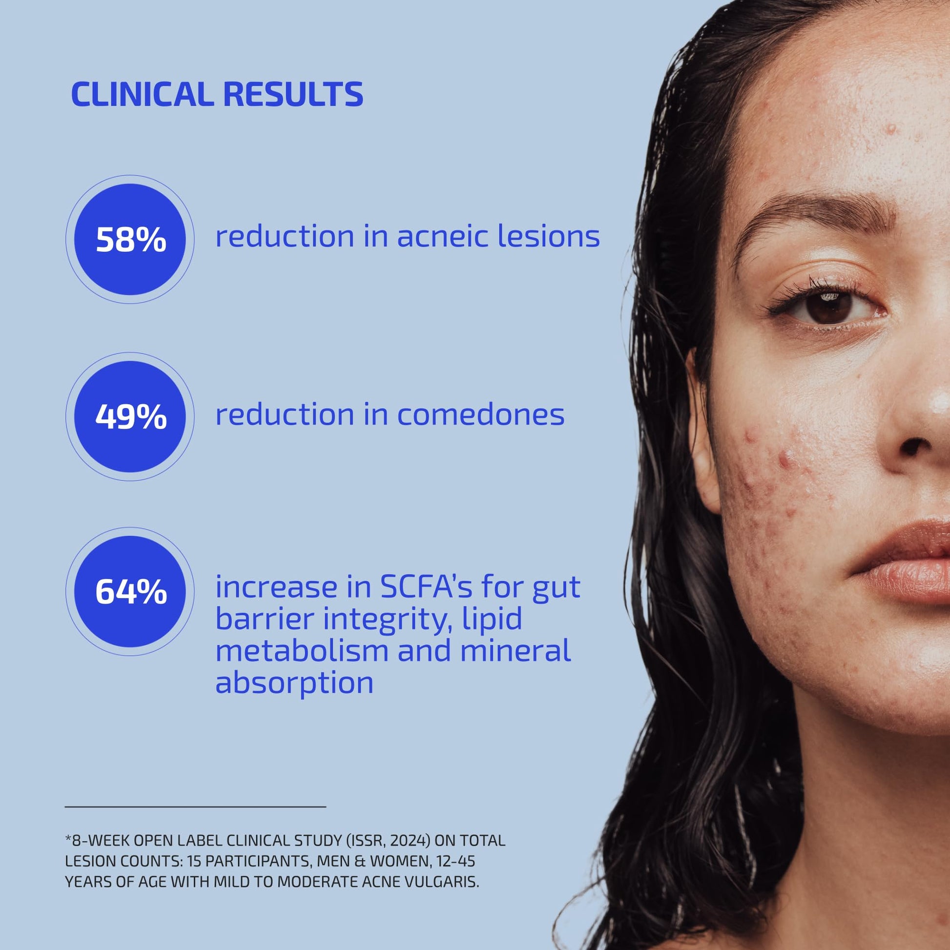 Codex Labs Shaant Clear Skin Supplement – 60 Vegan Capsules | Acne Probiotics with 9-Strain Blend, Green Tea EGCG & Guggul – Daily Support for Acne-Prone Skin & Clear Complexion Codex Labs Au supplements