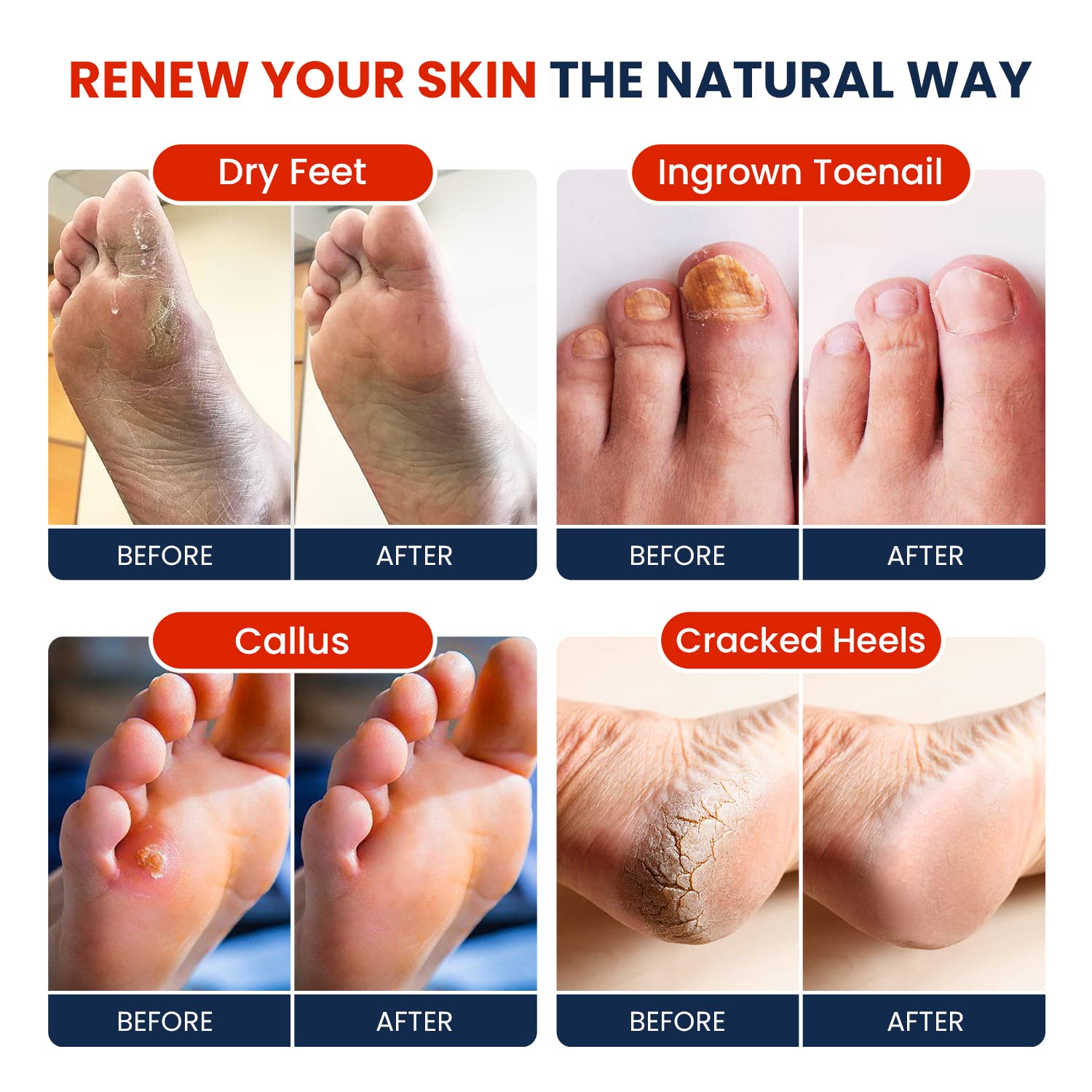 Muscle Relief Foot Soak with Epsom Salts - All Natural Salts for Post Workout Recovery FOOT CURE Au supplements