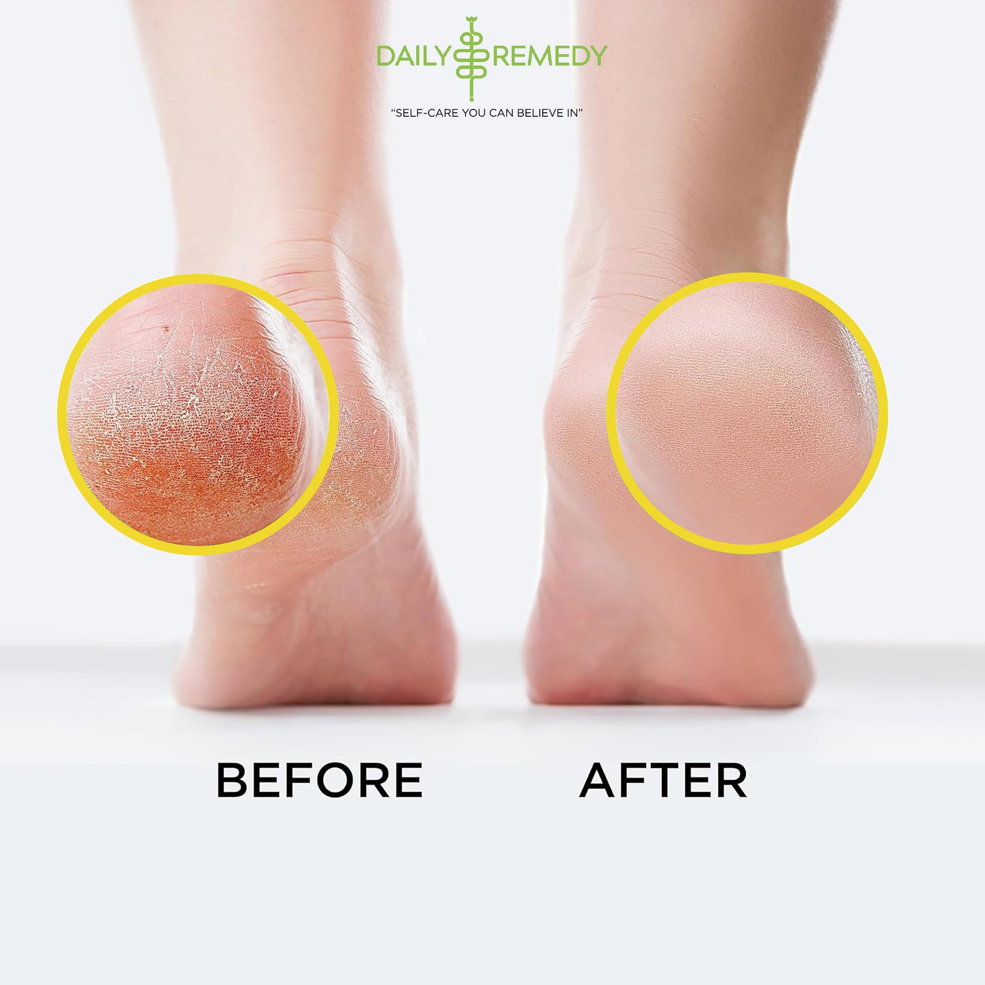 Citrus Detox Foot Soak with Epsom Salt - for Foot Callus, Immune Boost, Damaged Toenail DAILY REMEDY Au supplements