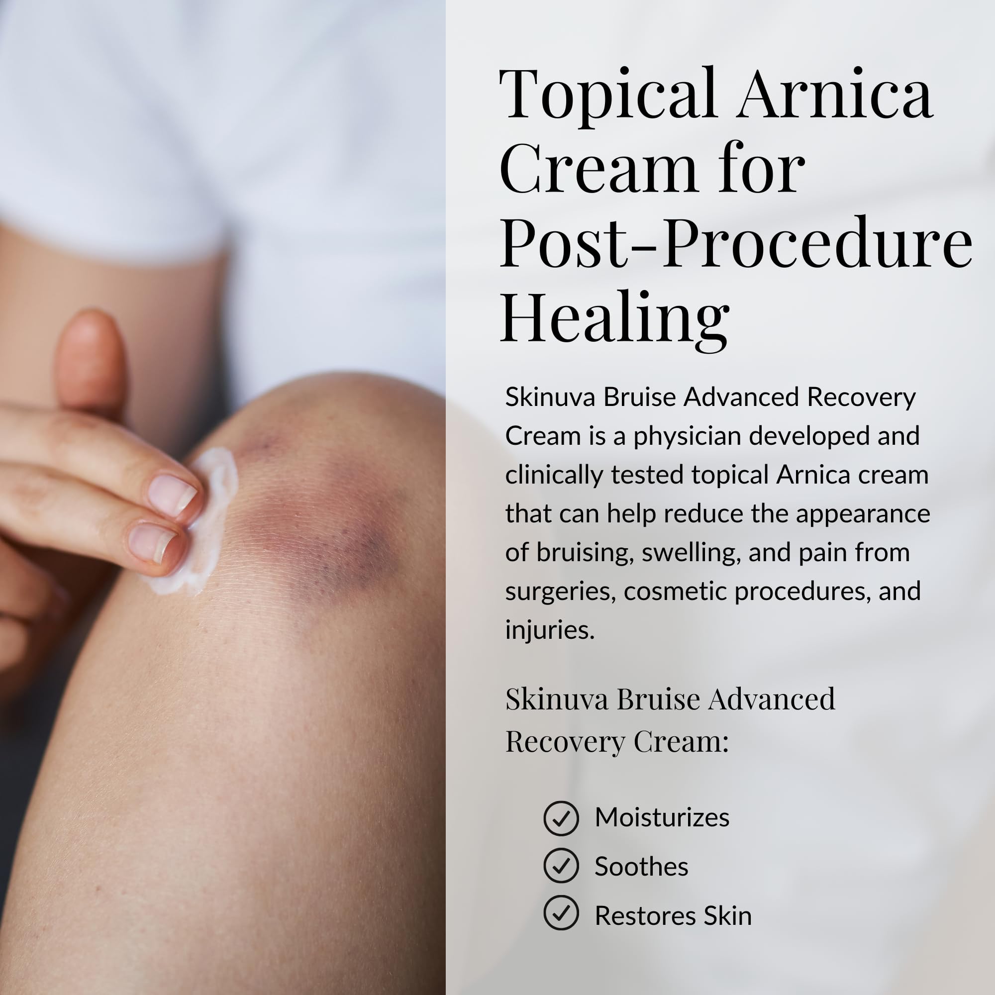 Skinuva® Bruise Advanced Recovery Cream - Topical Bruise Cream Formulated with Growth Factors, Arnica & Vitamin K (1 oz) Skinuva Au supplements