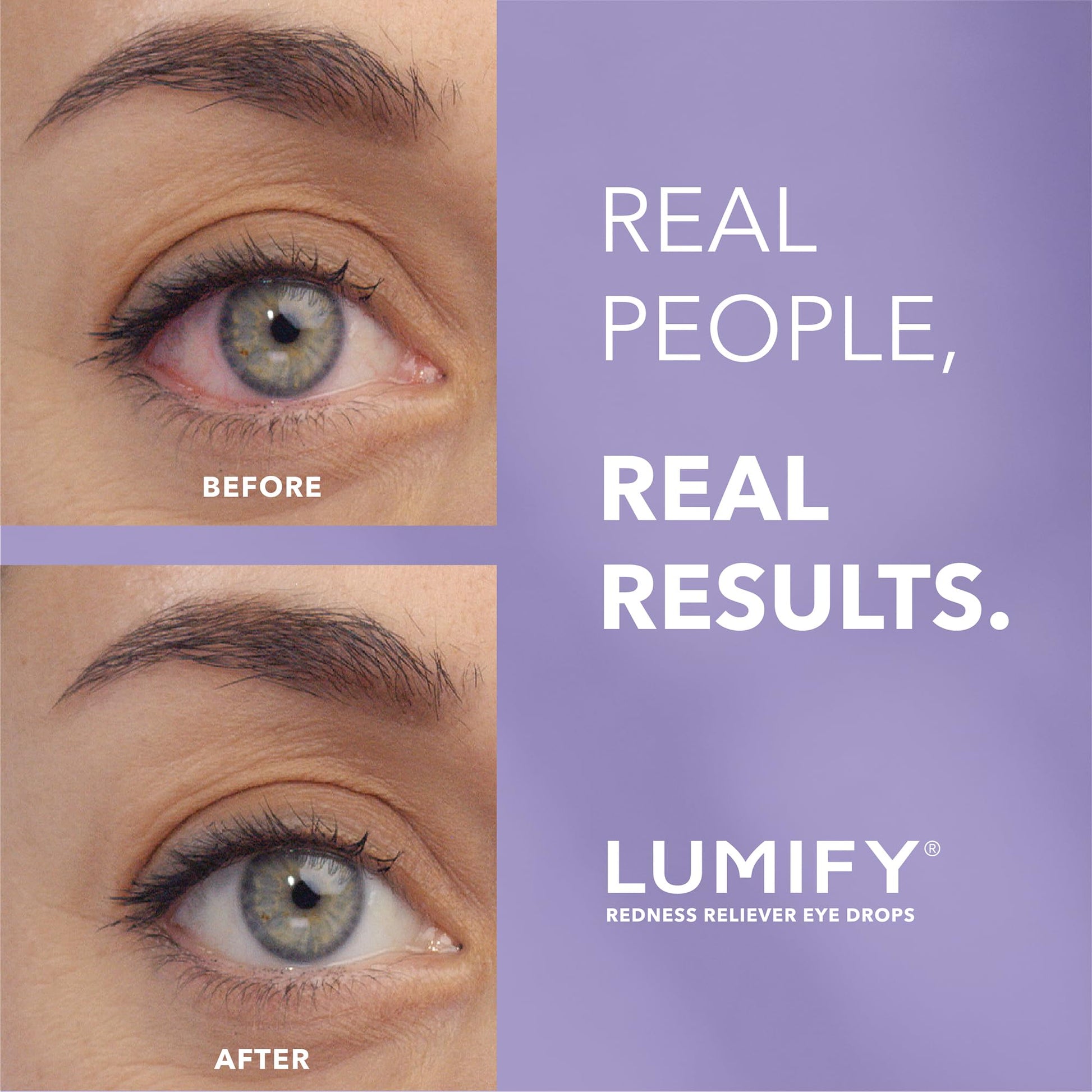 LUMIFY Eye Drops for Red Eyes, Redness Reliever for Brighter Looking Eyes, Works in 1 Minute & Lasts Up to 8 Hours, Eye Drops, 0.17 Fl Oz (5 mL) LUMIFY Au supplements