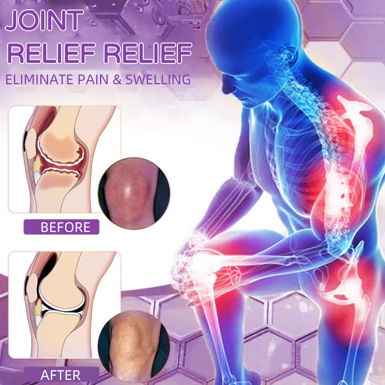 Flexbalm Rapid Joint Relief Therapy Gel 2.0, 2026 New Professional Relief Soothing Massage Gel, Flexbalm Rapid Joint Relief Cream for Back, Knee, Hands, Neck, Feet, for All Skin Types (2 Bottle) dooeka Au supplements