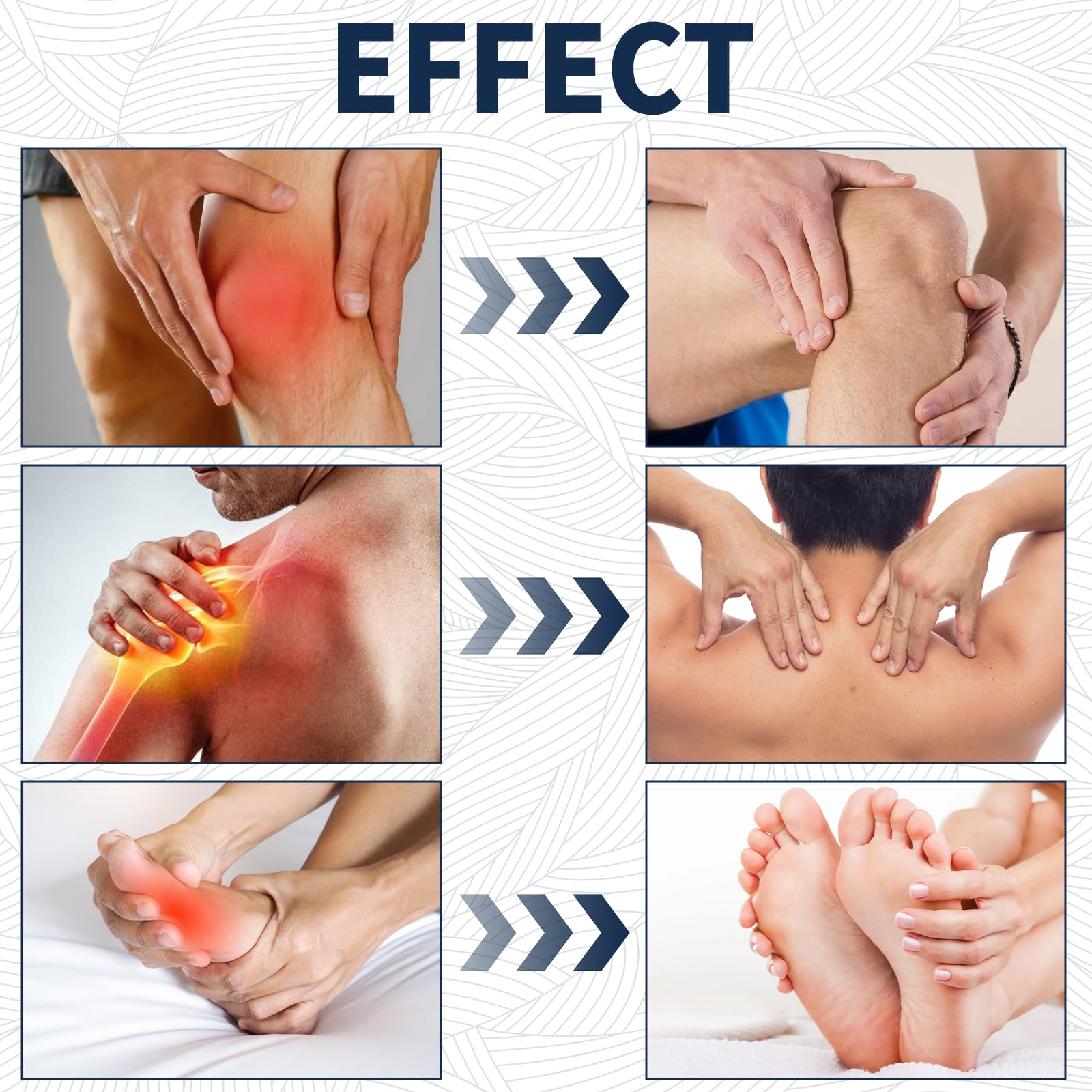YIVANNUO 2PCS Neuropathy Relief Cream, Contains Arnica, Menthol, Msm, and Glucosamine, Suitable for Feet, Hands, Legs, Muscles, Joints, and Waist, Fast Absorption, Mild & All Natural YIVANNUO Au supplements