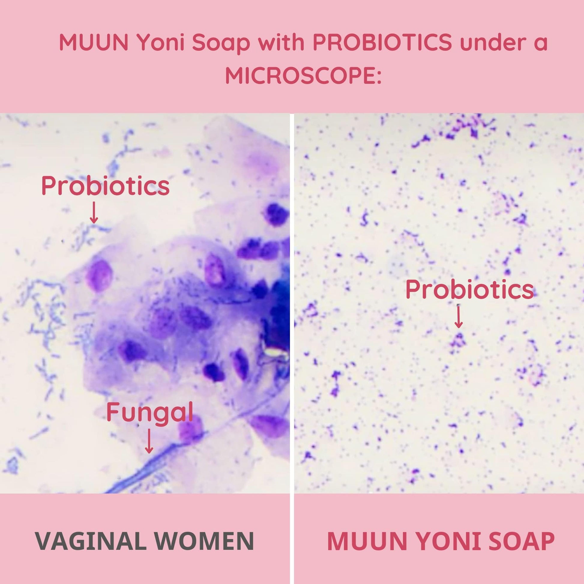 Muun Yoni Soap Bar - Pack 3 Ph Balance Probiotics & Natural Ingredients - Gentle Cleansing Formula Muun Au supplements