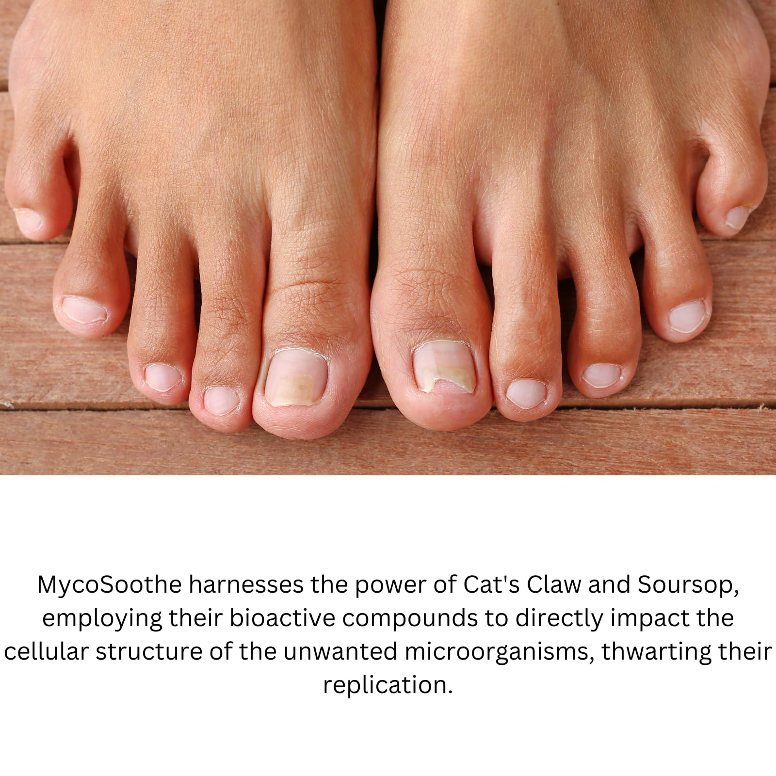 Phytage Labs MycoSoothe Advanced Hair, Skin, Nail & Immunity Support Formula - 60 Capsules Phytage Labs Au supplements
