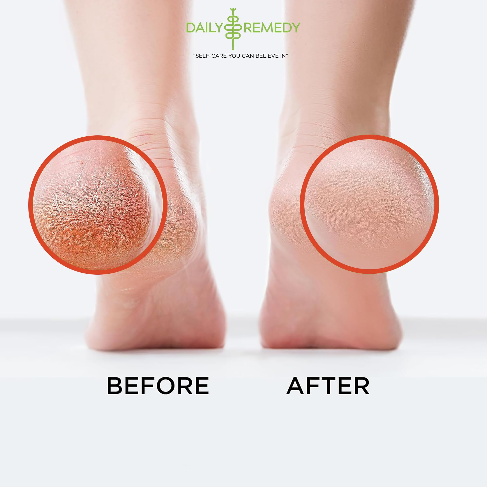 Muscle Relief Foot Soak with Epsom Salt, Made in USA, Soothe Foot Aches, Muscle Pain DAILY REMEDY Au supplements