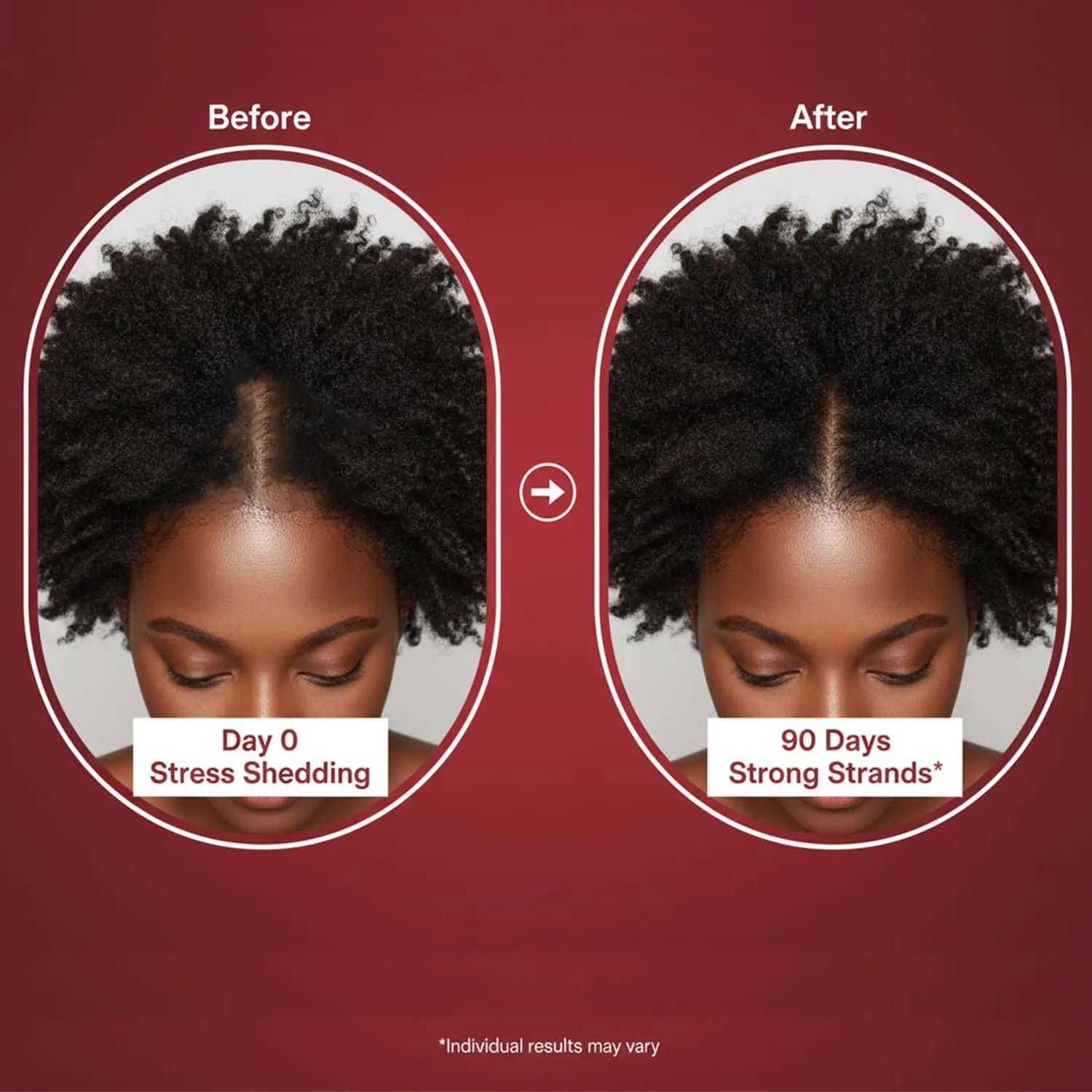 Lumin Hair Growth Gummies for Black Women, 60 Vegan Gummies, Daily Hair Nourishment with Biotin, Collagen & Botanical Extracts, Supports Healthy Hair Growth & Strength Lumin Hair Au supplements