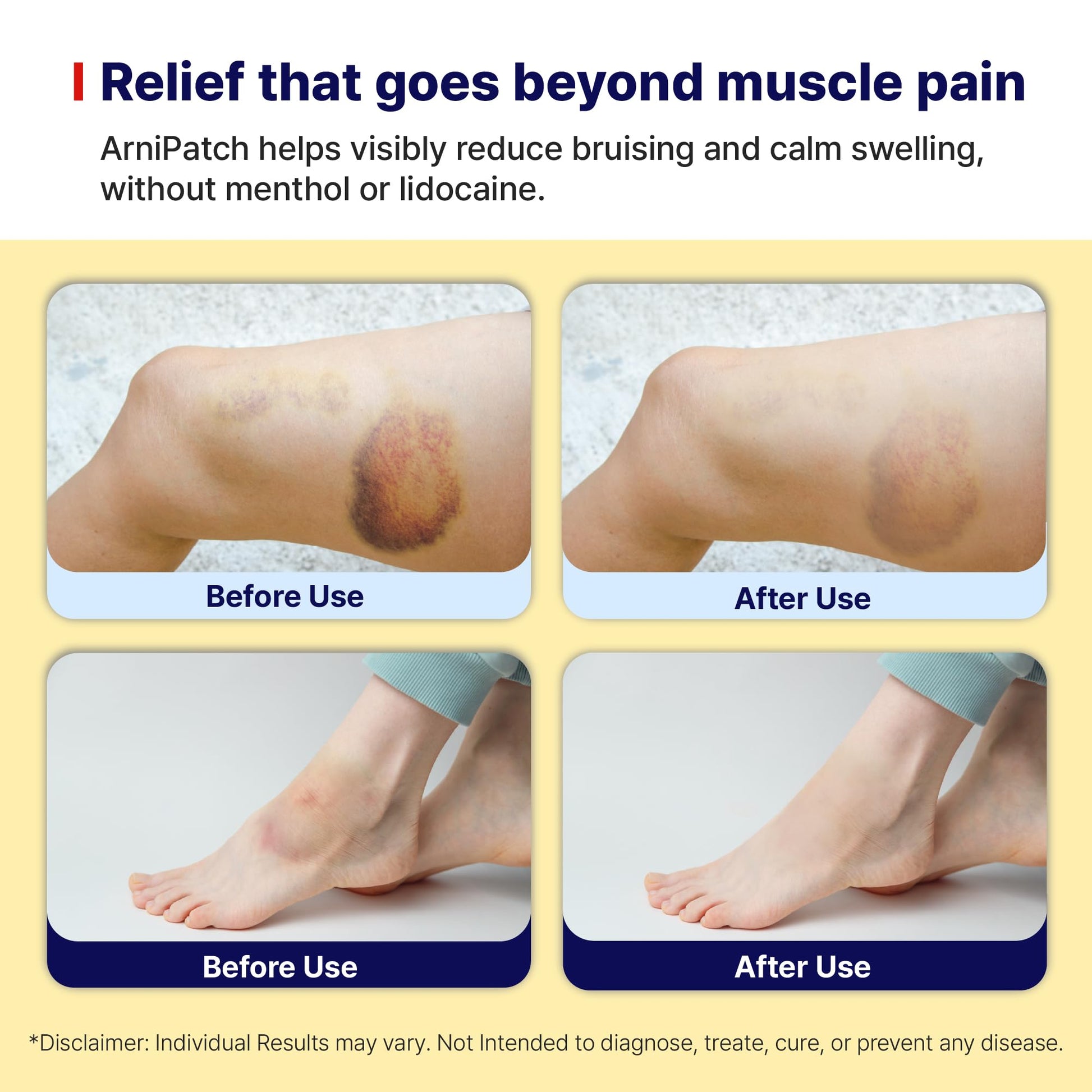 Arnica Hydrogel Pain Relief Patches | Natural Relief for Muscle, Joint, Bruises & Swelling | Flexible, Non-Greasy & Long-Lasting | Great for Back, Knee & Neck Pain (3.9"x4.7", 10, Count) Wooshin Labottach Au supplements