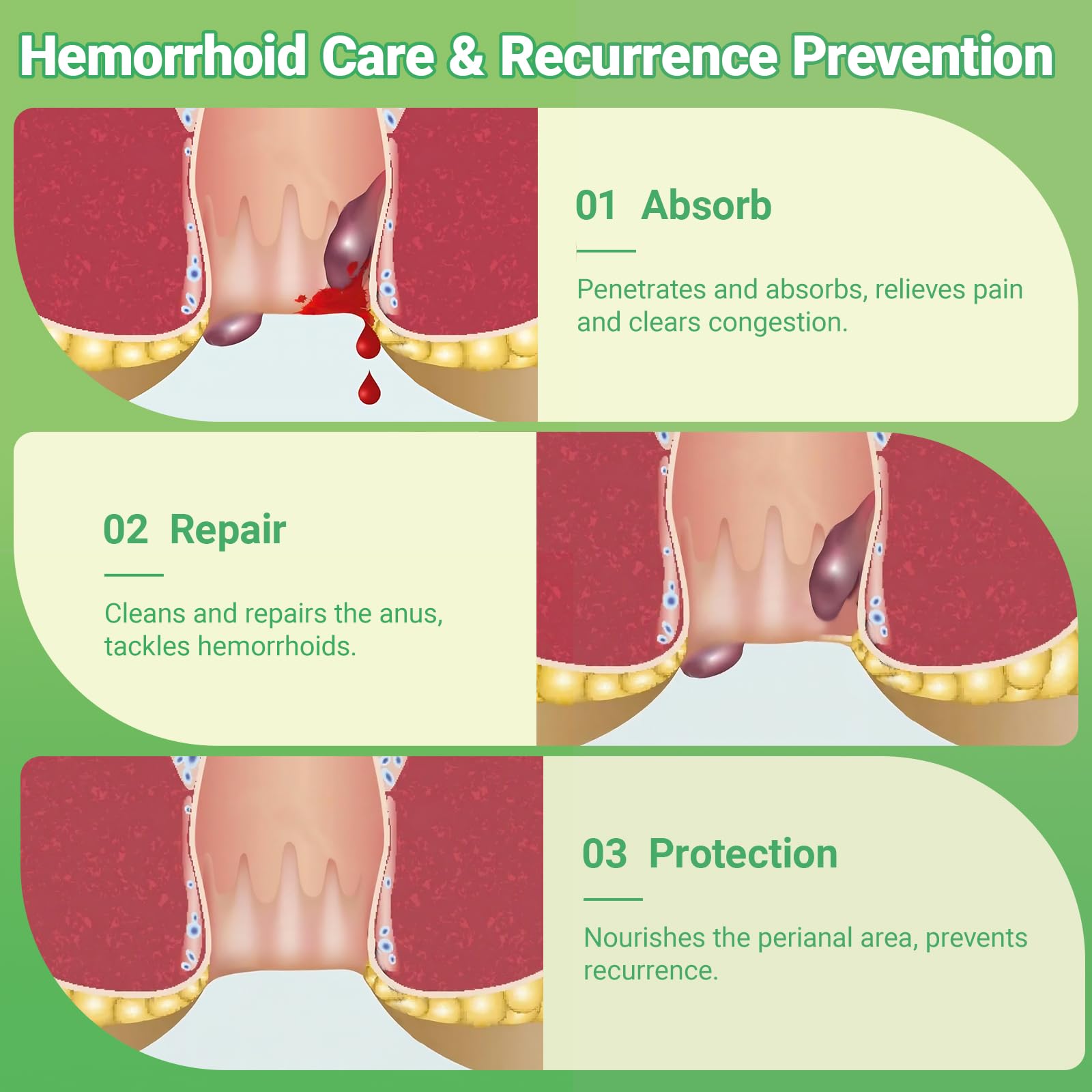 Hemorrhoid Treatment Ointment - Tubesmaximum Strength - Fast Relief from Pain, Itching, Burning, Swelling & Fissures | Natural Aloe & Vitamin E | Travel-Friendly10g x 5 Pieces Tubes - (1.76 Oz) yimimde Au supplements